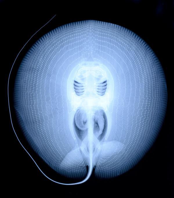 x-ray of a stingray